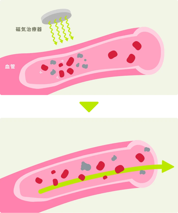 磁気治療のメカニズム